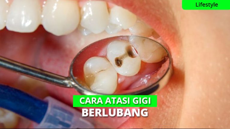 Cara Jitu Mengatasi Sakit Gigi Berlubang Tanpa Obat Dokter