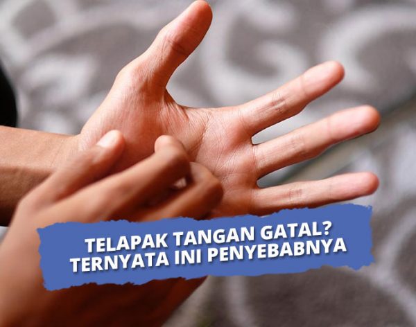 10 Penyebab Telapak Tangan Gatal And Cara Mengatasinya