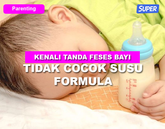 warna feses bayi tidak cocok susu formula