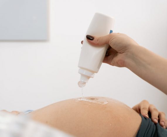 9. Yoghurt untuk ibu hamil Melawan kulit kering dan pigmentasi