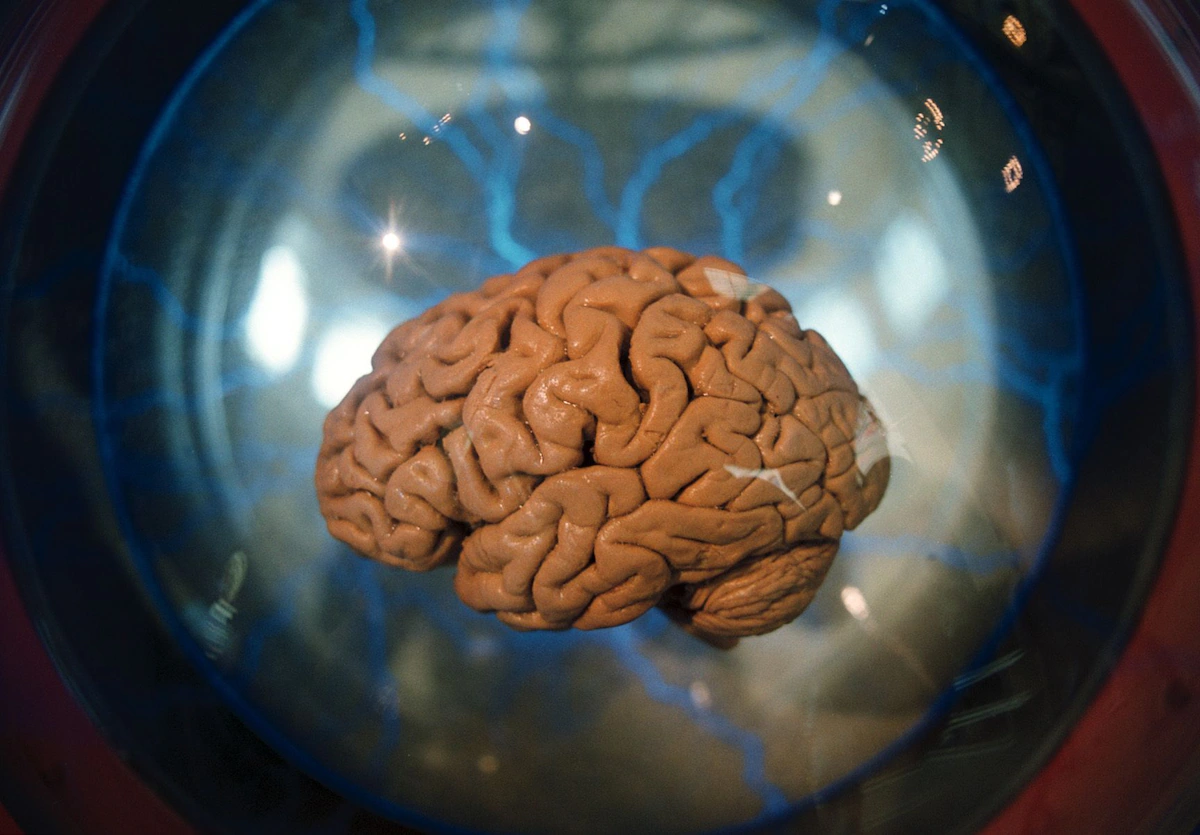 Brain otak