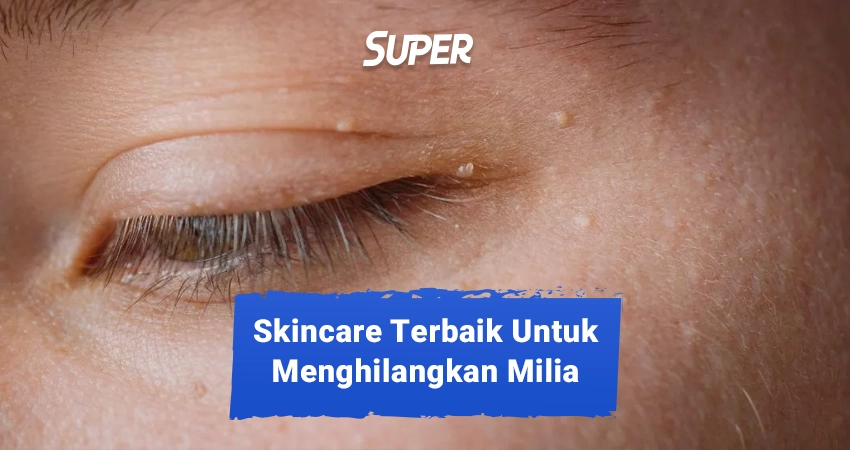 skincare untuk menghilangkan milia